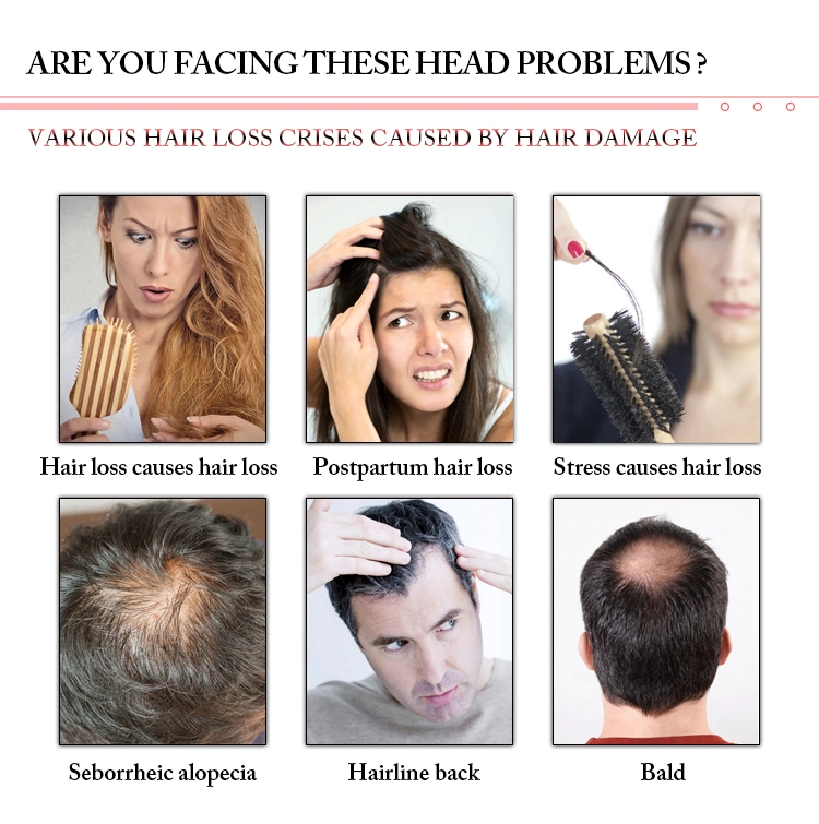 660nm Diode Laser Anti-Hair Loss Treatment Hair Regrowth Beauty Equipment