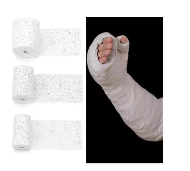 High Quality Orthopedic Pop Bandage Factory Direct Sale Plaster of Paris Bandage Roll