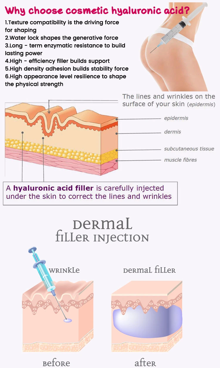 Korea Silicone Gel Acid Hyaluronic Filler Face and Body Injection 20ml
