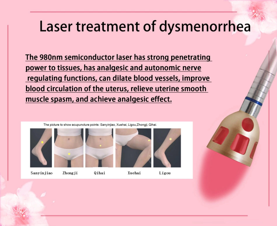 Diode Laser 980nm Blood Vessels Removal Treatment for Beauty Salon