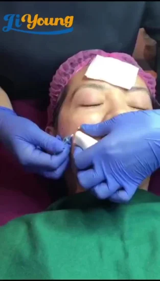 Mono / Screw Cog Thread Skin Care Face Lifting Pdo Thread for Beauty Pdo Thread for Nose